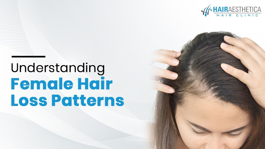 female hair loss patterns